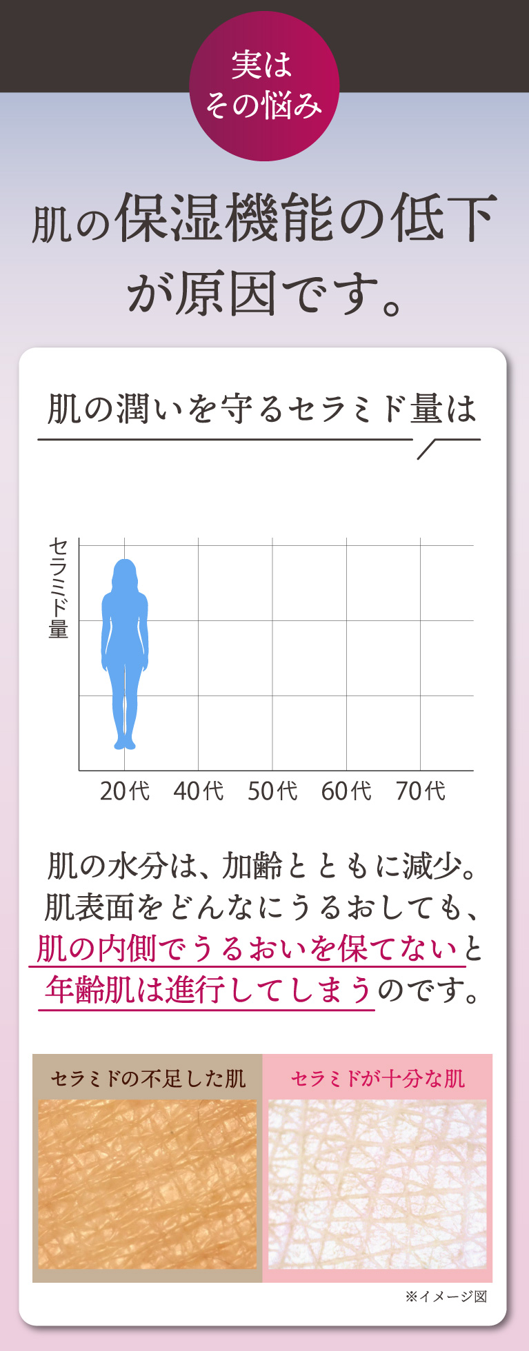 肌の保湿機能の低下が原因です。